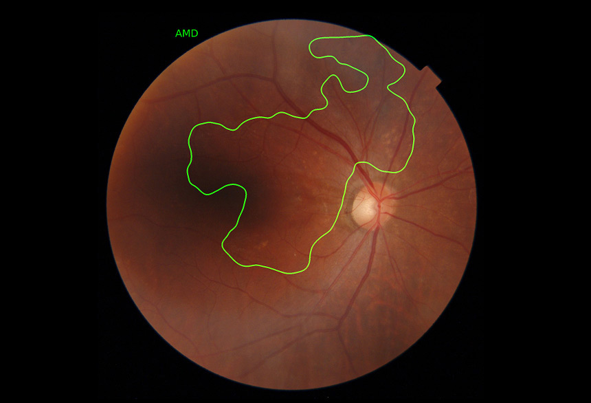 Dr. Noon Fundus