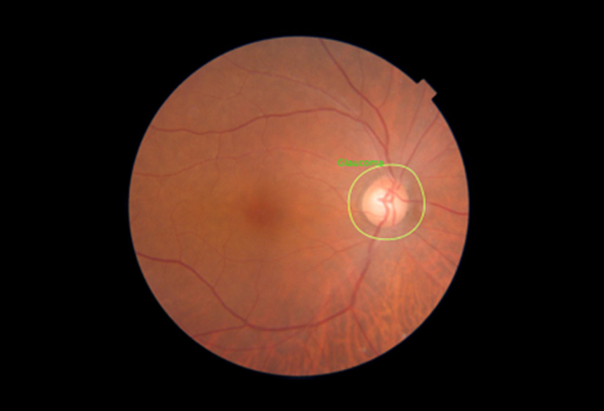 Dr. Noon Fundus