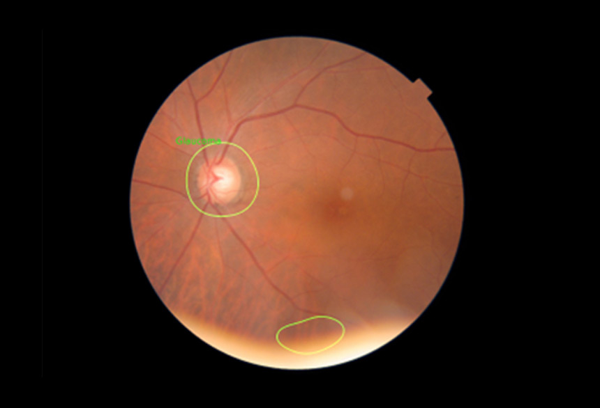 Dr. Noon Fundus