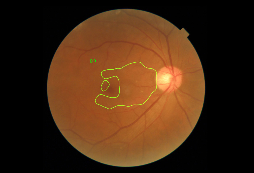 Dr. Noon Fundus