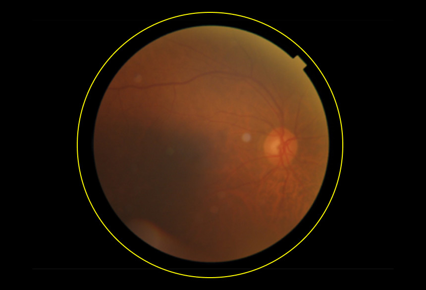 Dr. Noon Fundus