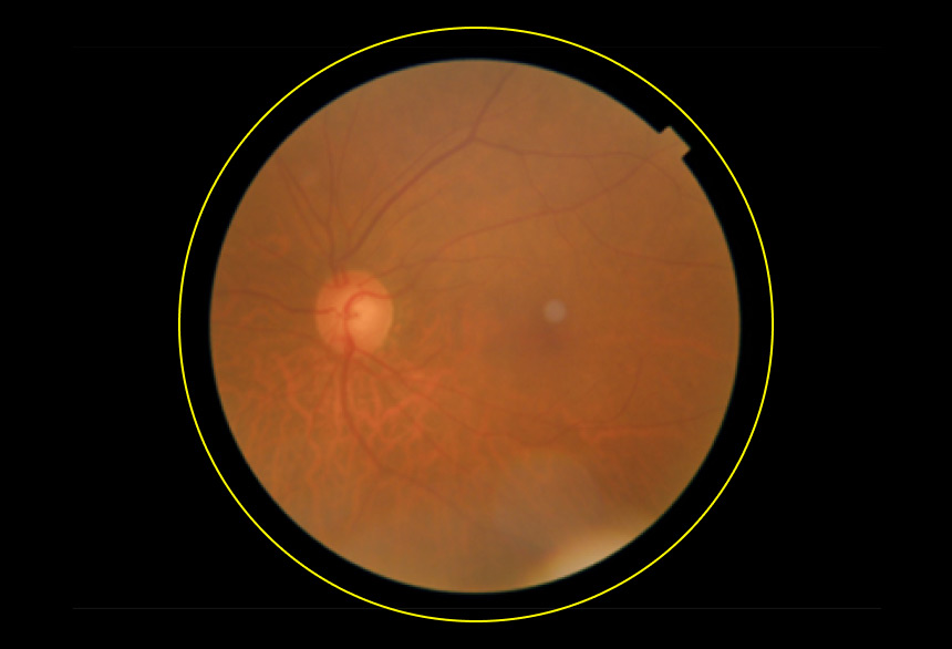 Dr. Noon Fundus